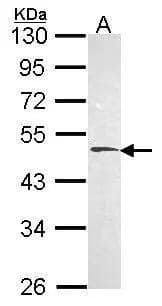 Sample (30 ug of whole cell lysate)  A: Hela  10% SDS PAGE  HYAL1 antibody  NBP2-16906 diluted at 1:1000  