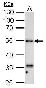 HYAL1 antibody detects HYAL1 protein by Western blot analysis.A. 50 ug Rat liver lysate/extract10 % SDS-PAGEHYAL1 antibody (NBP2-16906) dilution: 1:1000 