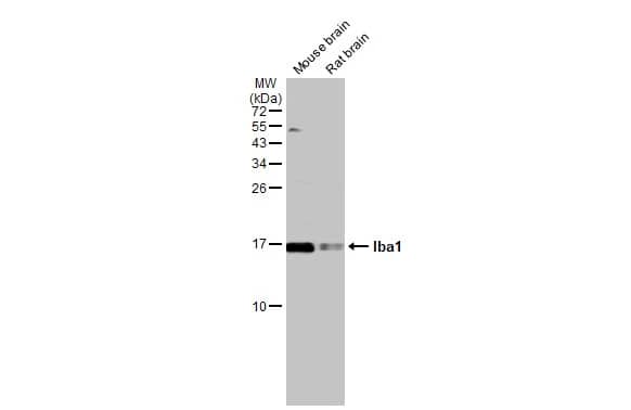 Western Blot: AIF-1/Iba1 Antibody [NBP2-16908] - Various tissue extracts (50 ug) were separated by 15% SDS-PAGE, and the membrane was blotted with AIF-1/Iba1 antibody (NBP2-16908) diluted at 1:500. The HRP-conjugated anti-rabbit IgG antibody  was used to detect the primary antibody.