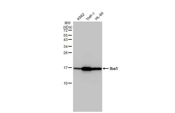 Western Blot: AIF-1/Iba1 Antibody [NBP2-16908] - Various whole cell extracts (30 ug) were separated by 15% SDS-PAGE, and the membrane was blotted with AIF-1/Iba1 antibody (NBP2-16908) diluted at 1:5000. The HRP-conjugated anti-rabbit IgG antibody  was used to detect the primary antibody.