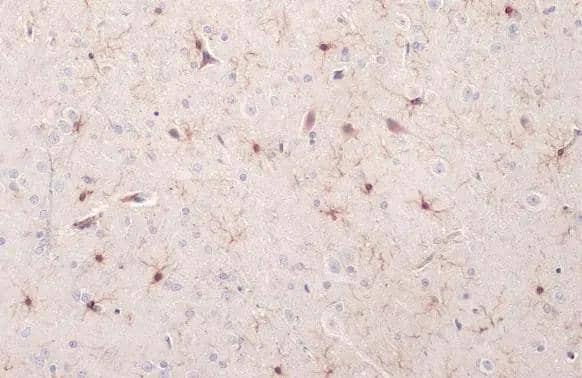 Iba1 antibody detects Iba1 protein at cell membrane and cytoplasm by immunohistochemical analysis.Sample: Paraffin-embedded rat brain.Iba1 stained by Iba1 antibody (NBP2-16908) diluted at 1:500.Antigen Retrieval: Citrate buffer, pH 6.0, 15 min 