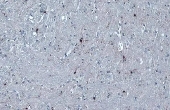 Iba1 antibody detects Iba1 protein at cell membrane and cytoplasm by immunohistochemical analysis.Sample: Paraffin-embedded mouse cerebellum.Iba1 stained by Iba1 antibody (NBP2-16908) diluted at 1:1000.Antigen Retrieval: Citrate buffer, pH 6.0, 15 min 