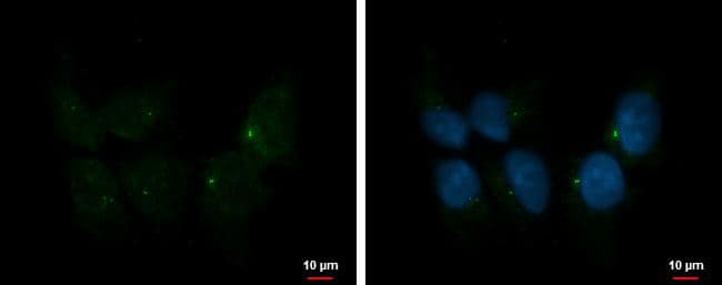 Immunocytochemistry/ Immunofluorescence Ift80 Antibody - BSA Free
