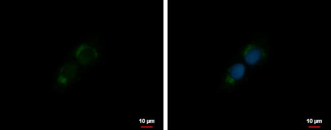 Immunocytochemistry/ Immunofluorescence: IGF-I/IGF-1 Antibody [NBP2-16929] - IGF-I/IGF-1 antibody detects IGF-I/IGF-1 protein at Golgi apparatus membrane by immunofluorescent analysis.Sample: SKNSH cells were fixed in 4% paraformaldehyde at RT for 15 min.Green: IGF-I/IGF-1 protein stained by IGF-I/IGF-1 antibody (NBP2-16929) diluted at 1:500.Blue: Hoechst 33342 staining.Scale bar = 10 um.