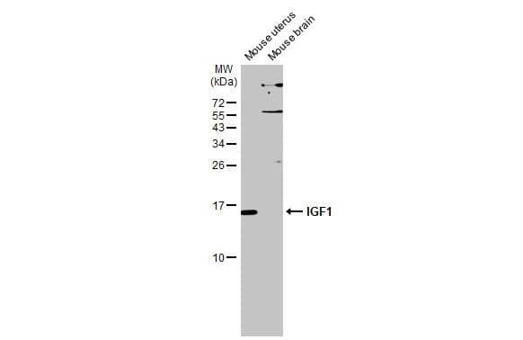 Western Blot IGF-I/IGF-1 Antibody - BSA Free