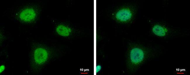 Immunocytochemistry/ Immunofluorescence IGF2BP3 Antibody - BSA Free