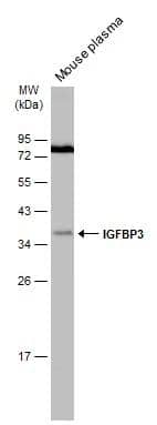 Mouse plasma (30 ug) was separated by 12% SDS-PAGE, and the membrane was blotted with IGFBP3 antibody (NBP2-16933) diluted at 1:1000. The HRP-conjugated anti-rabbit IgG antibody  was used to detect the primary antibody. 