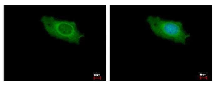 IKAP antibody [C1C2], Internal detects IKAP protein at cytoplasm by immunofluorescent analysis. Sample: HeLa cells were fixed in ice-cold MeOH for 5 min.Green: IKAP protein stained by IKBKAP antibody [C1C2], Internal (NBP2-16936) diluted at 1:500.Blue: Hoechst 33343 staining. 