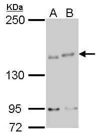 IKAP antibody [C1C2], Internal detects IKAP protein by western blot analysis.A. 30 ug GL261 whole cell lysate/extract B. 30 ug Raw264.7 whole cell lysate/extract5% SDS-PAGEIKAP antibody [C1C2], Internal (NBP2-16936) dilution: 1:500 The HRP-conjugated anti-rabbit IgG antibody  was used to detect the primary antibody. 