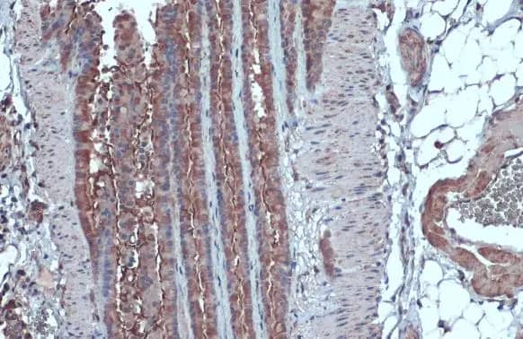 Immunohistochemistry-Paraffin: IL-13R alpha 1 Antibody [NBP2-16942] - IL-13R alpha 1 antibody detects IL-13R alpha 1 protein at cell membrane and cytoplasm by immunohistochemical analysis.Sample: Paraffin-embedded mouse lung.IL-13R alpha 1 stained by IL-13R alpha 1 antibody (NBP2-16942) diluted at 1:500.Antigen Retrieval: Citrate buffer, pH 6.0, 15 min