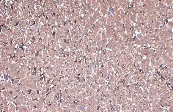 Immunohistochemistry-Paraffin: IL-13R alpha 1 Antibody [NBP2-16942] - IL-13R alpha 1 antibody detects IL-13R alpha 1 protein at cytoplasm by immunohistochemical analysis.Sample: Paraffin-embedded rat liver.IL-13R alpha 1 stained by IL-13R alpha 1 antibody (NBP2-16942) diluted at 1:500.Antigen Retrieval: Citrate buffer, pH 6.0, 15 min