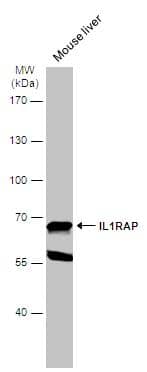 Mouse tissue extract (50 ug) was separated by 7.5% SDS-PAGE, and the membrane was blotted with IL1RAP antibody [N1N3] (NBP2-16946) diluted at 1:500. The HRP-conjugated anti-rabbit IgG antibody  was used to detect the primary antibody. 