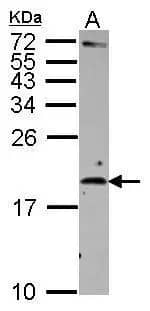 Western Blot: IL-2 Antibody [NBP2-16948] - Sample (30 ug of whole cell lysate)  A: Raji   15% SDS PAGE  NBP2-16948 diluted at 1:500 