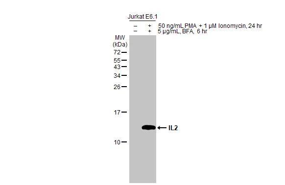 Untreated (-) and treated (+) Jurkat E6.1 whole cell extracts (30 ug) were separated by 15% SDS-PAGE, and the membrane was blotted with IL2 antibody (NBP2-16948) diluted at 1:500. The HRP-conjugated anti-rabbit IgG antibody  was used to detect the primary antibody. 