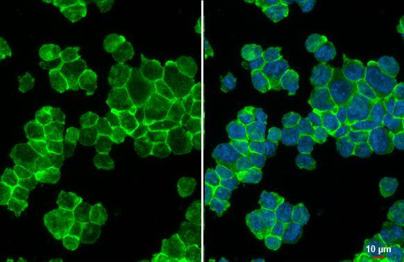 IL3 Receptor beta antibody [N1N3] detects IL3 Receptor beta protein at cell membrane by immunofluorescent analysis.Sample: THP-1 cells were fixed in 4% paraformaldehyde at RT for 15 min.Green: IL3 Receptor beta stained by IL3 Receptor beta antibody [N1N3] (NBP2-16954) diluted at 1:500.Blue: Fluoroshield with DAPI . 
