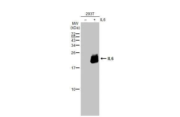 Non-transfected (-) and transfected (+) 293T whole cell extracts (30 ug) were separated by 12% SDS-PAGE, and the membrane was blotted with IL6 antibody (NBP2-16957) diluted at 1:1500. The HRP-conjugated anti-rabbit IgG antibody  was used to detect the primary antibody. 