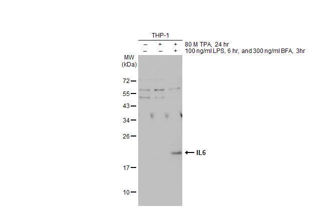 Untreated (-) and treated (+) THP-1 whole cell extract (30 ug) were separated by 12% SDS-PAGE, and the membrane was blotted with IL6 antibody (NBP2-16957) diluted at 1:500. The HRP-conjugated anti-rabbit IgG antibody  was used to detect the primary antibody. 