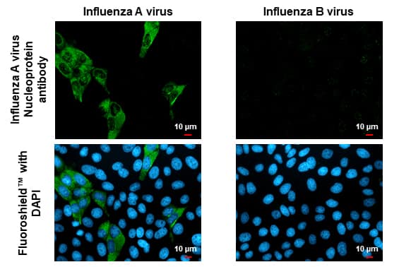 Immunocytochemistry/ Immunofluorescence: Influenza A H1N1 Nucleoprotein Antibody - (A/WSN/1933) [NBP2-16965] - Immunofluorescent analysis of Influenza virus infected cells using Influenza A H1N1 Nucleoprotein antibody antibody (NBP2-16965).Sample: Influenza A and B virus infected cells slide.Green: Influenza A H1N1 Nucleoprotein antibody antibody (NBP2-16965) diluted at 1:100.Blue: Fluoroshield with DAPI .