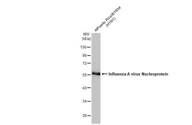 Influenza A (H1N1) viral lysate (0.1 ug) was separated by 10% SDS-PAGE, and the membrane was blotted with Influenza A virus Nucleoprotein antibody (NBP2-16965) diluted at 1:50000. The HRP-conjugated anti-rabbit IgG antibody  was used to detect the primary antibody. 