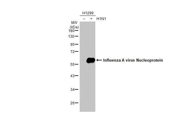 Non-infected (-) and infected (+) H1299 whole cell extracts (5 ug) were separated by 10% SDS-PAGE, and the membrane was blotted with Influenza A virus Nucleoprotein antibody (NBP2-16965) diluted at 1:10000. The HRP-conjugated anti-rabbit IgG antibody  was used to detect the primary antibody. 