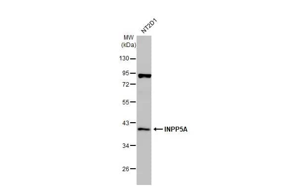 Western Blot: INPP5A Antibody [NBP2-16969] - Whole cell extract (30 ug) was separated by 10% SDS-PAGE, and the membrane was blotted with INPP5A antibody [N2C3] (NBP2-16969) diluted at 1:1000. The HRP-conjugated anti-rabbit IgG antibody  was used to detect the primary antibody.
