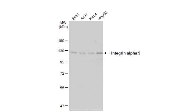 Various whole cell extracts (30 ug) were separated by 7.5% SDS-PAGE, and the membrane was blotted with Integrin alpha 9 antibody [N1N2], N-term (NBP2-16972) diluted at 1:1000. The HRP-conjugated anti-rabbit IgG antibody  was used to detect the primary antibody. 