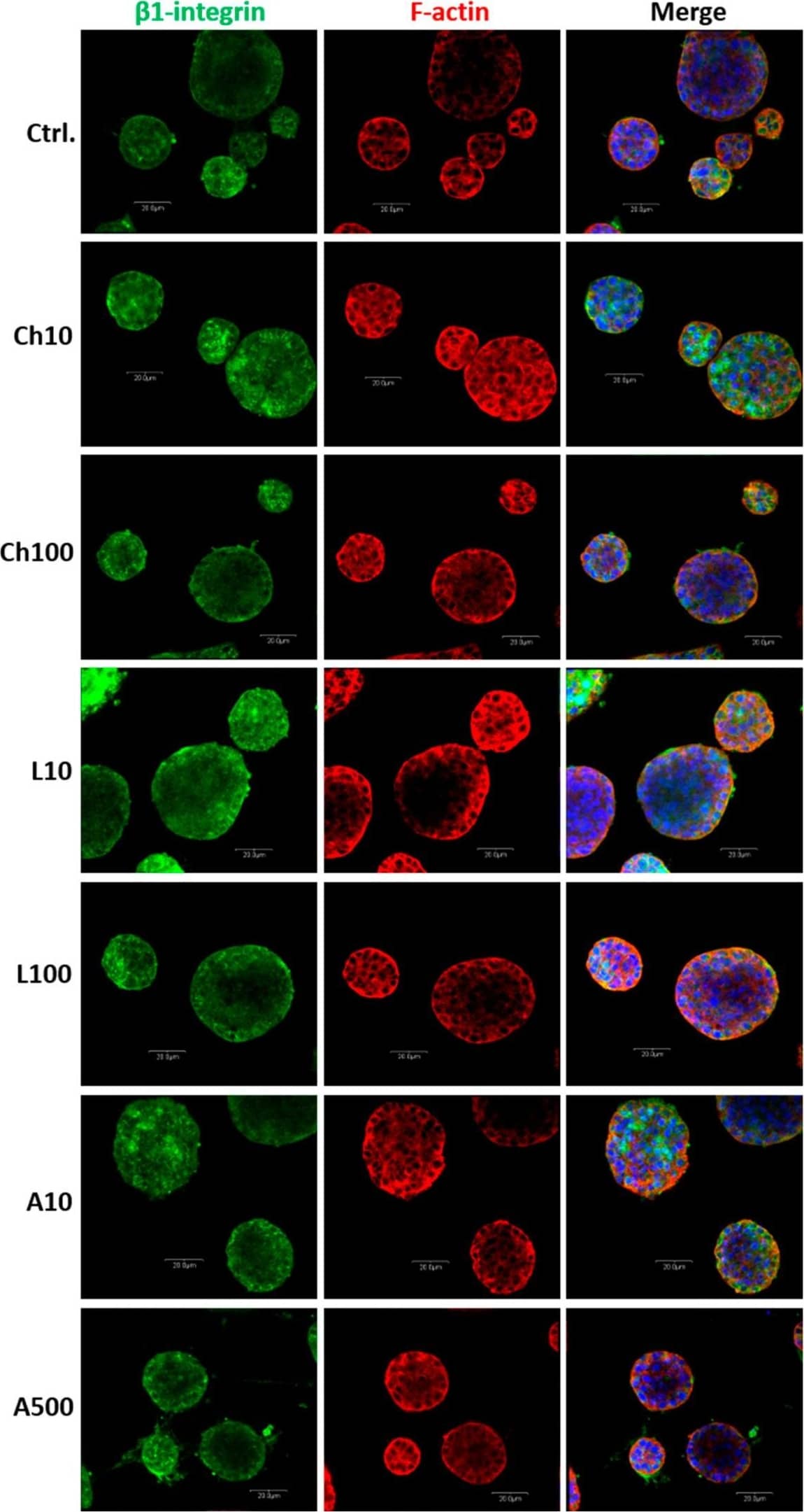 Panels of confocal micrographs presenting the immunofluorescence staining of BME-UV1 cells cultured on Matrigel for 11 days in control growth medium (Ctrl.) or medium supplemented with chemerin (Ch10 = 10 ng/mL, Ch100 = 100 ng/mL), leptin (L10 = 10 ng/mL, L100 = 100 ng/mL), or adiponectin (A10 = 10 ng/mL, A500 = 500 ng/mL). Cells were stained with primary antibodies against  beta 1-integrin and secondary antibodies conjugated with Alexa Fluor 488 dye (green fluorescence); Alexa Fluor 594 phalloidin, detecting F-actin (red fluorescence), and nuclei counterstained with Hoechst 33342 (blue fluorescence). Images were taken at 600× magnification and are representative for three independent experiments. Scale bar: 20 μm. Image collected and cropped by CiteAb from the following open publication (//www.mdpi.com/1422-0067/25/8/4147), licensed under a CC-BY license. Not internally tested by Novus Biologicals.