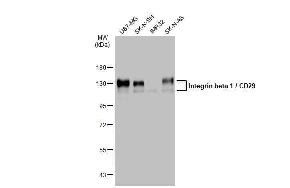 Various whole cell extracts (30 ug) were separated by 7.5% SDS-PAGE, and the membrane was blotted with Integrin beta 1 / CD29 antibody (NBP2-16974) diluted at 1:4000. The HRP-conjugated anti-rabbit IgG antibody  was used to detect the primary antibody. 