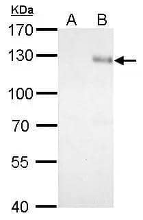 Integrin beta 1 / CD29 antibody detects Integrin beta 1 / CD29 protein by western blot analysis.A. 30 ug 293T whole cell lysate/extractB. 30 ug whole cell lysate/extract of human Integrin beta 1 / CD29-transfected 293T cells7.5% SDS-PAGEIntegrin beta 1 / CD29 antibody (NBP2-16974) dilution: 1:5000 The HRP-conjugated anti-rabbit IgG antibody  was used to detect the primary antibody. 