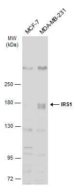 Various whole cell extracts (30 ug) were separated by 5% SDS-PAGE, and the membrane was blotted with IRS1 antibody [C2C3], C-term (NBP2-16992) diluted at 1:1000. The HRP-conjugated anti-rabbit IgG antibody  was used to detect the primary antibody. 