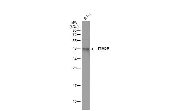 Western Blot: ITM2B Antibody [NBP2-17000] - Whole cell extract (30 ug) was separated by 12% SDS-PAGE, and the membrane was blotted with ITM2B antibody (NBP2-17000) diluted at 1:5000. The HRP-conjugated anti-rabbit IgG antibody  was used to detect the primary antibody.