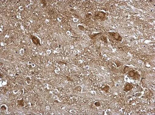 Immunohistochemistry: ITM2B Antibody [NBP2-17000] - ITM2B antibody detects ITM2B protein at Golgi apparatus on mouse esophagus by immunohistochemical analysis. Sample: Paraffin-embedded mouse brain stem. ITM2B antibody (NBP2-17000) dilution: 1:500.Antigen Retrieval: Trilogy™ (EDTA based, pH 8.0) buffer, 15min