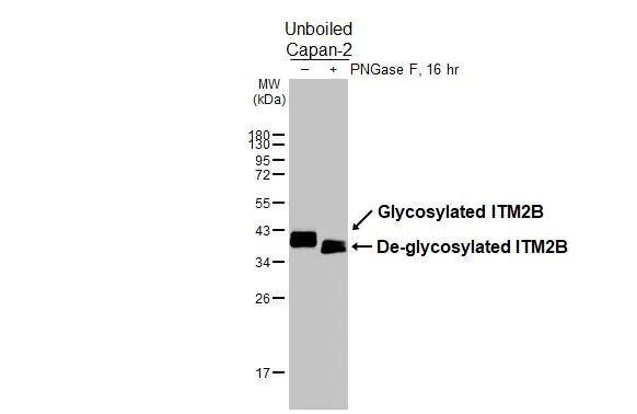 Untreated (-) and treated (+) unboiled Capan-2 whole cell extracts (30 ug) were separated by 12% SDS-PAGE, and the membrane was blotted with ITM2B antibody (NBP2-17000) diluted at 1:1000. The HRP-conjugated anti-rabbit IgG antibody  was used to detect the primary antibody. 