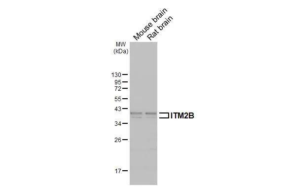Various tissue extracts (50 ug) were separated by 12% SDS-PAGE, and the membrane was blotted with ITM2B antibody (NBP2-17000) diluted at 1:500. The HRP-conjugated anti-rabbit IgG antibody  was used to detect the primary antibody. 