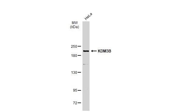 Western Blot: JMJD1B Antibody [NBP2-17007] - Whole cell extract (30 ug) was separated by 5% SDS-PAGE, and the membrane was blotted with JMJD1B antibody [C2C3], C-term (NBP2-17007) diluted at 1:1000. The HRP-conjugated anti-rabbit IgG antibody  was used to detect the primary antibody.