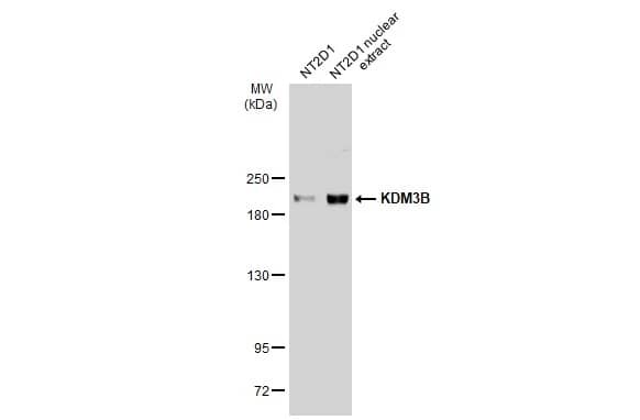 Western Blot: JMJD1B Antibody [NBP2-17007] - NT2D1 whole cell and nuclear extracts (30 ug) were separated by 5% SDS-PAGE, and the membrane was blotted with JMJD1B antibody [C2C3], C-term (NBP2-17007) diluted at 1:1000. The HRP-conjugated anti-rabbit IgG antibody  was used to detect the primary antibody.