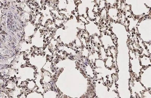 GCN5 antibody [C2C3], C-term detects GCN5 protein at cytoplasm and nucleus by immunohistochemical analysis.Sample: Paraffin-embedded mouse lung.GCN5 stained by GCN5 antibody [C2C3], C-term (NBP2-17017) diluted at 1:500.Antigen Retrieval: Citrate buffer, pH 6.0, 15 min 