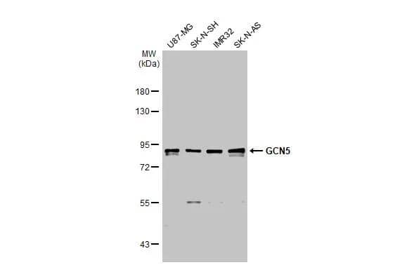 Various whole cell extracts (30 ug) were separated by 7.5% SDS-PAGE, and the membrane was blotted with GCN5 antibody [C2C3], C-term (NBP2-17017) diluted at 1:1000. The HRP-conjugated anti-rabbit IgG antibody  was used to detect the primary antibody. 