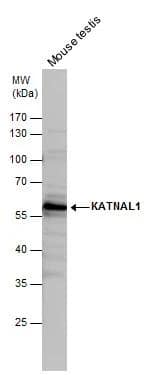 Western Blot KATNAL1 Antibody - BSA Free