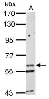 Sample (30 ug of whole cell lysate)  A: HepG2  7.5% SDS PAGE  NBP2-17027 diluted at 1:1000  