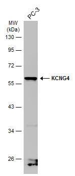 Whole cell extract (30 ug) was separated by 10% SDS-PAGE, and the membrane was blotted with KCNG4 antibody (NBP2-17028) diluted at 1:1000. The HRP-conjugated anti-rabbit IgG antibody  was used to detect the primary antibody. 