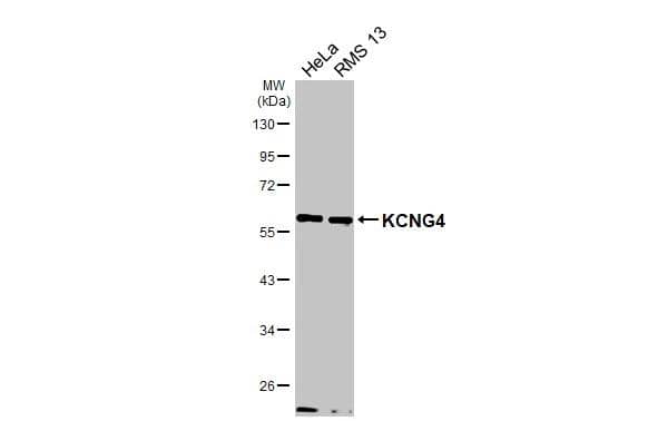 Various whole cell extracts (30 ug) were separated by 10% SDS-PAGE, and the membrane was blotted with KCNG4 antibody (NBP2-17028) diluted at 1:1000. The HRP-conjugated anti-rabbit IgG antibody  was used to detect the primary antibody. 