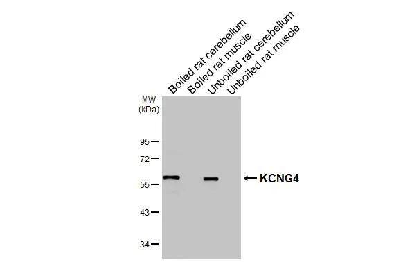 Boiled and unboiled various tissue extracts (50 ug) were separated by 10% SDS-PAGE, and the membrane was blotted with KCNG4 antibody (NBP2-17028) diluted at 1:1000. The HRP-conjugated anti-rabbit IgG antibody  was used to detect the primary antibody. 