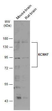 Western Blot Kv11.3 Antibody