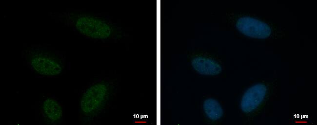 Immunocytochemistry/ Immunofluorescence: KCTD15 Antibody [NBP2-17030] - KCTD15 antibody detects KCTD15 protein at nucleus by immunofluorescent analysis.Sample: HeLa cells were fixed in 4% paraformaldehyde at RT for 15 min.Green: KCTD15 protein stained by KCTD15 antibody (NBP2-17030) diluted at 1:500.Blue: Hoechst 33342 staining.Scale bar = 10 um.