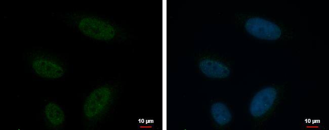 KCTD15 antibody detects KCTD15 protein at nucleus by immunofluorescent analysis.Sample: HeLa cells were fixed in 4% paraformaldehyde at RT for 15 min.Green: KCTD15 protein stained by KCTD15 antibody (NBP2-17030) diluted at 1:500.Blue: Hoechst 33342 staining.Scale bar = 10 um. 