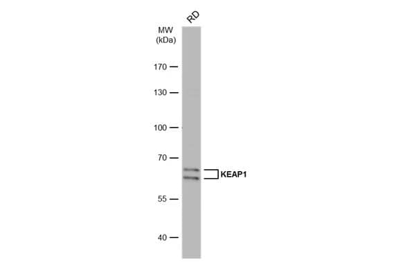 Western Blot: Keap1 Antibody [NBP2-17036] - Whole cell extract (30 ug) was separated by 7.5% SDS-PAGE, and the membrane was blotted with Keap1 antibody [C1C3] (NBP2-17036) diluted at 1:500. The HRP-conjugated anti-rabbit IgG antibody  was used to detect the primary antibody, and the signal was developed with Trident ECL plus-Enhanced.