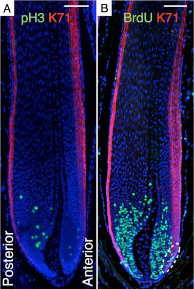 Immunocytochemistry/ Immunofluorescence: Cytokeratin 71 Antibody [NBP2-17040] - Densities of proliferating & apoptotic cells in a spine follicle. Longitudinal sections of a 28-day-old Acomys.(A) pH3 (green), K71 (red), & Hoechst (blue) immunostaining. (B) BrdU (green), K71 (red), & Hoechst (blue) immunostaining. (C) BrdU (green), TUNEL (red), & Hoechst (blue) immunostaining. (D–F) Color-coded local relative densities in a radius that corresponds to 3% of the image diagonal (blue: low density, red: high density) of cells labelled with Hoechst (D), BrdU (E), & TUNEL (F). Scale bars: 100 μm. Image collected & cropped by CiteAb from the following publication (//evodevojournal.biomedcentral.com/articles/10.1186/2041-9139-5-33), licensed under a CC-BY license. Not internally tested by Novus Biologicals.