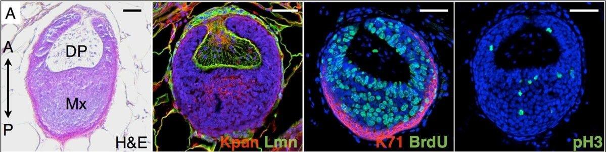 Immunocytochemistry/ Immunofluorescence: Cytokeratin 71 Antibody [NBP2-17040] - Observed & simulated cell proliferation & cell death along a spine follicle. Transverse sections (28-day-old Acomys) are taken along the spine long axis, from the basis of the follicle (rows A-C), to the DP-medulla transition (rows D-E), to the collapse of the keratinized medulla (rows F-G). H&E, Hematoxylin & Eosin staining. Immunostaining: Kpan, Pan-Keratin (red); Lmn, Laminin (green); BrdU, 5-bromo-2'-deoxyuridine (green); K71, keratin 71 (red); pH3, phospho-Histone H3 (green); TUNEL (red), Hoechst (blue). Arrows: IRS, DP: dermal papilla, Mx: matrix, C: cortex, M: medulla. Simulated transverse sections (Sim) are snapshots of the Supplementary Movie 2 showing time evolution of a simulated follicle. Scale bars: 50 μm. Image collected & cropped by CiteAb from the following publication (//evodevojournal.biomedcentral.com/articles/10.1186/2041-9139-5-33), licensed under a CC-BY license. Not internally tested by Novus Biologicals.