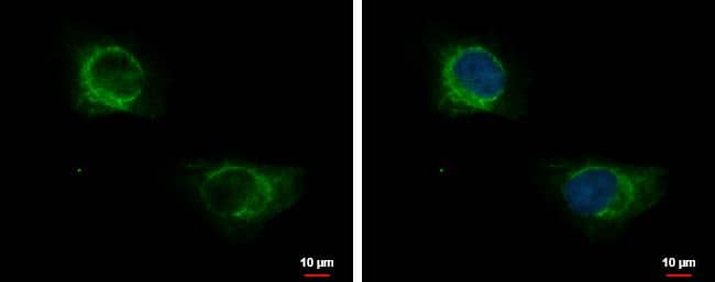 KRT71 antibody [N3C3] detects KRT71 protein at cytoplasm by immunofluorescent analysis.Sample: HeLa cells were fixed in 4% paraformaldehyde at RT for 15 min.Green: KRT71 protein stained by KRT71 antibody [N3C3] (NBP2-17040) diluted at 1:500.Blue: Hoechst 33342 staining.Scale bar = 10 um. 